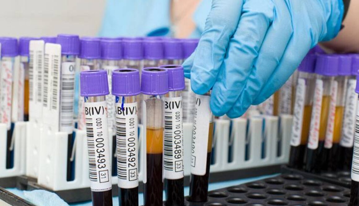 Dog Blood Tests Explained